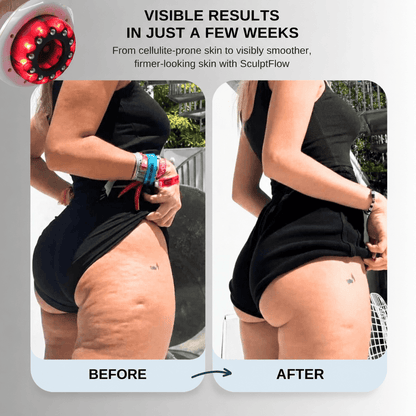 SculptFlow | Deep-Tissue Massager for Lighter-Feeling Legs & Smoother-Looking Skin