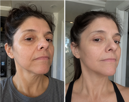 GlowLift™ | Facial Care & Massage Device